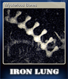 Series 1 - Card 4 of 5 - Mysterious Bones