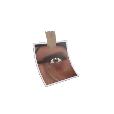 Strange Snapped Pupil