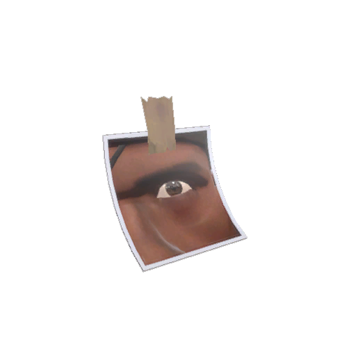 Strange Snapped Pupil